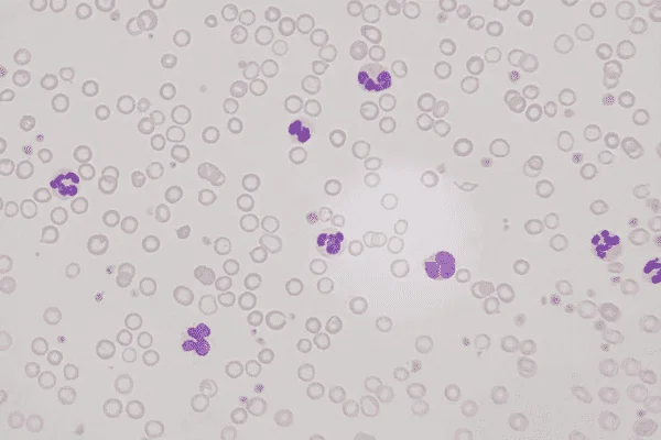 60x / 0.80na Infinity Plan DRY Objective - Image 3